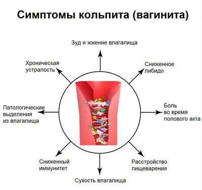 Кольпит - причины появления, симптомы заболевания, диагностика и способы  лечения