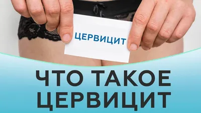 Цервицит - признаки, причины, симптомы, лечение и профилактика - iDoctor.kz