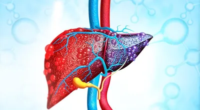 Что такое цирроз печени и как он возникает — блог медицинского центра ОН  Клиник