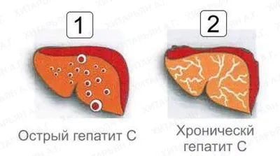 https://www.phag-rostov.ru/articles/bolit-pechen-pri-gepatite/