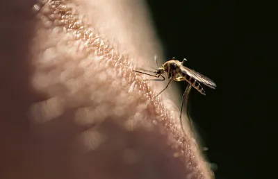 Как избавиться от укуса комара: советы врача | РБК Стиль