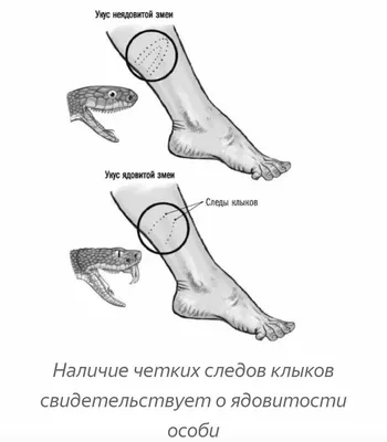 Как отличить ядовитую змею от неядовитой. Интересно знать! | Интересно  знать! | ВКонтакте