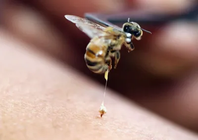 В чём разница «укуса» пчелы и осы? Как устроено их жало, как происходит  атака и как работает их яд? | Пикабу