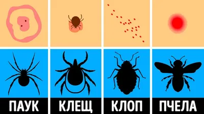 Как распознать укус насекомого и что с ним делать - YouTube