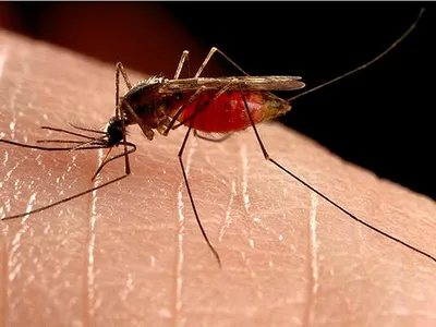 Семь действенных методов, помогающих снять зуд от комариных укусов - KP.RU