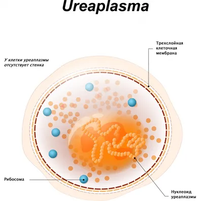 Уреаплазмоз. Уреаплазма (уреалитикум, парвум, специес) - причины появления,  симптомы заболевания, диагностика и способы лечения