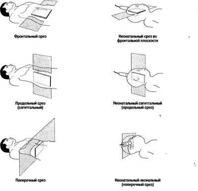 Руководство по ультразвуковой диагностике