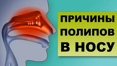 УВЕЛИЧЕННЫЕ ГЛАНДЫ – о чем это говорит? - YouTube