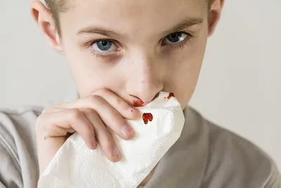 12 симптомов, которые помогут распознать лейкоз у ребенка - Новости  здоровья - Здоровье 24