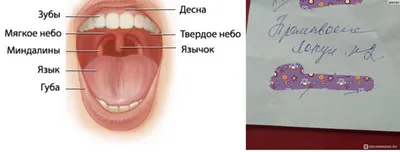 Санация (промывание) гланд (миндалин) в стационаре - «Реально ли УМЕНЬШИТЬ  миндалины? Как побороть страх, какое средство выбрать и ОБРАЗ жизни после  промывания миндалин, чтобы добиться положительных результатов. Мой опыт  промывания гланд, а