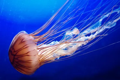 Медики БСМП Челнов спасли от ампутации руку мужчине, которого ужалила медуза