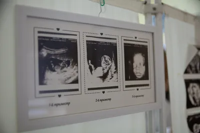 Правда про УЗИ: где пройти УЗИ в Тюмени беременным и тем, кто планирует  стать мамой - 26 марта 2020 - 72.ru