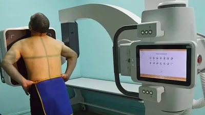 В больнице Муравленко установили цифровой флюорограф | Ямал-Медиа