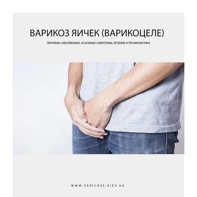Варикоз яичек (Варикоцеле): симптомы и методы лечения ⋆ varicose.kiev.ua