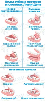 Съемные Зубные Протезы На Челюсти [3 Вида]- Люмидент
