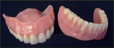 Съемные зубные протезы в Одессе, установить съемный протез, съемное  протезирование по доступной цене