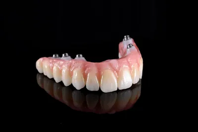 Протезирование зубов в Кишиневе. Зубные протезы в стоматологии Saniodent