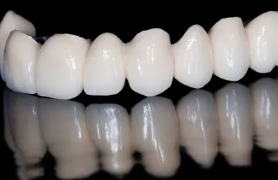 Протезирование зубов в Кишиневе. Зубные протезы в стоматологии Saniodent