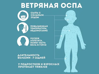 Профилактика ветряной оспы