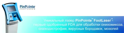 Удаление бородавок в Москве ✓ Клиника подологии Полёт