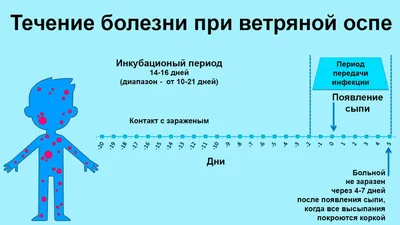 Ветрянка у детей: информация о ветряной оспе, симптомы, инкубационный  период, чем лечить