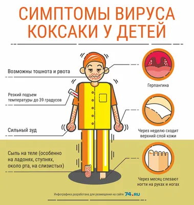 Что такое вирус Коксаки: симптомы, профилактика, лечение - 18 августа 2017  - 72.ru