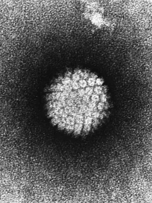 Папилломавирусы — Википедия