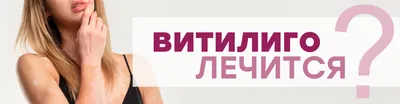 Можно ли все-таки вылечить витилиго?