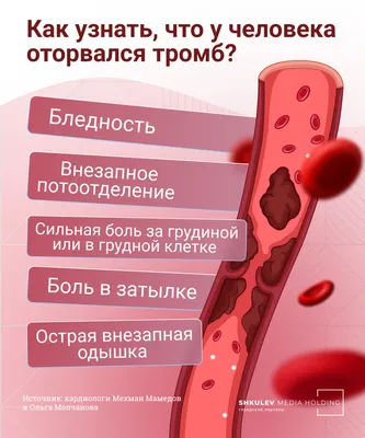 Тромб: чем опасен его отрыв, кто находится в группе риска, как избежать  образования тромба - 16 января 2023 - chita.ru
