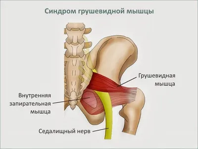 Блуждающие боли по всему телу: причины и лечение - Evexia