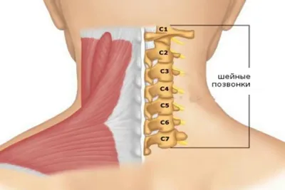 Лечение боли в шее