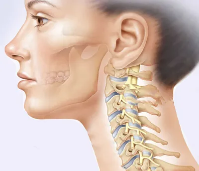 Лечение грыжи шейного отдела позвоночника без операции: особенности, методы  лечения, стоит ли торопиться с операцией