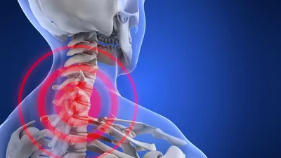 Болит шея - Клиника остеопатии \"Качество жизни\"\"