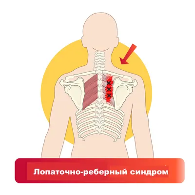 Защемление седалищного нерва: симптомы | Блог о здоровье