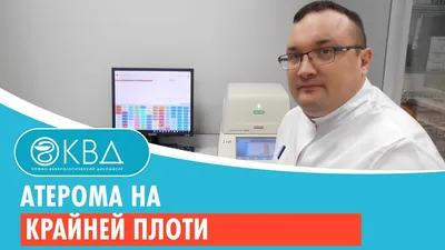 Удаление атеромы лазером - цены в клинике Санкт-Петербурга