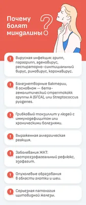 Миндалины болят и появился налет: чем лечить воспаление, что делать с  пробками