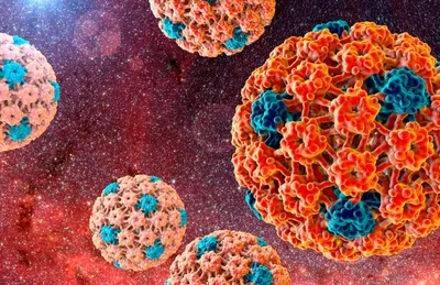 Вирус папилломы человека может спровоцировать рак – профилактика и защита  от инфекции