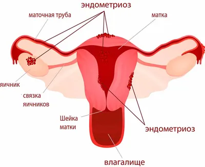 Коричневые выделения перед месячными | КВДКоричневые выделения перед  месячными: гинеколог в Москве.