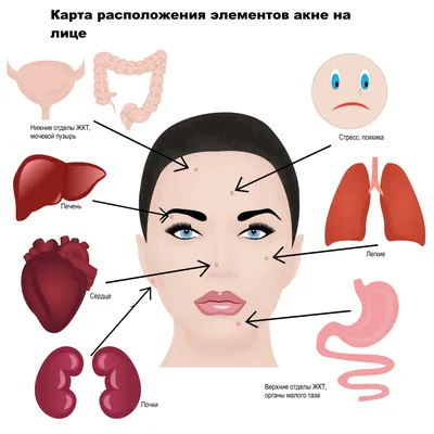 Прыщи на лице - причины появления, при каких заболеваниях возникает,  диагностика и способы лечения