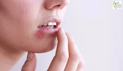Почему зудит во рту: чтобы избавиться от неприятного симптома, найдите его  причину - Все про аллергию