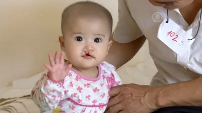 Детям с «заячьей губой» делают бесплатные операции (новости) - YouTube