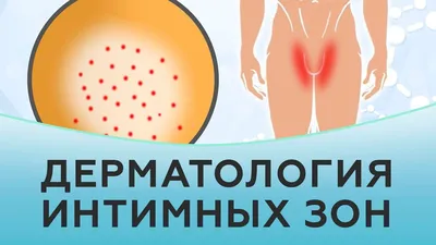 Почему у меня часто появляется герпес? А он может перерасти в онкологию?  Врач-инфекционист отвечает на тревожные вопросы про герпес - CityDog.io