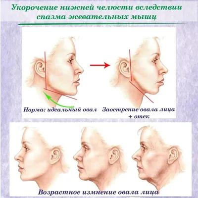 Расслабление жевательных мышц. Самомассаж лица для омоложения - YouTube