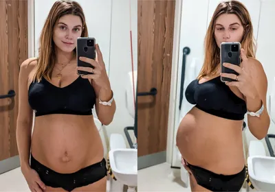 Звезда телешоу показала живот через два часа после родов, и честные фото  шокировали Instagram
