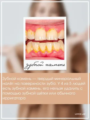 Ирригатор Скалер Отбеливание зубов Удаление зубного камня Loyce Lab  26053599 купить за 2 640 ₽ в интернет-магазине Wildberries